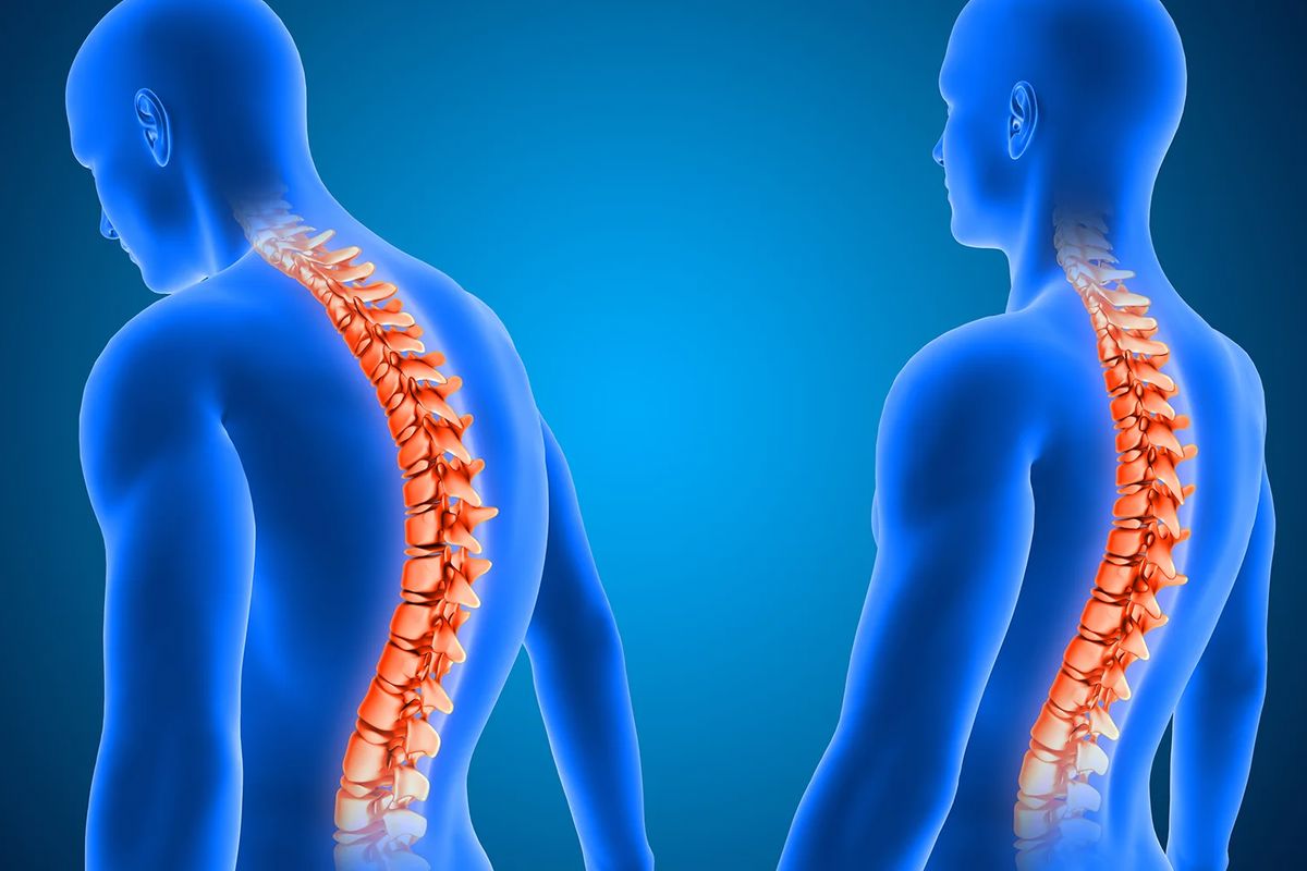 علاج الانزلاق الغضروفي