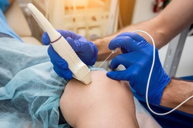 العلاج بالتردد الحراري