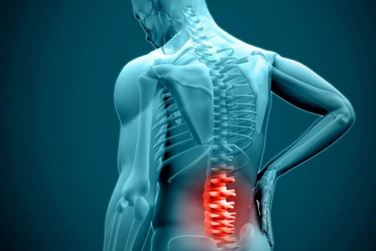 خطوات علاج الغضروف القطني بدون جراحة