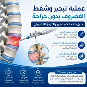 عملية تبخير وشفط الغضروف بدون جراحة