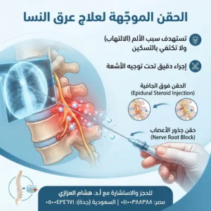 حقن لعلاج عرق النسا