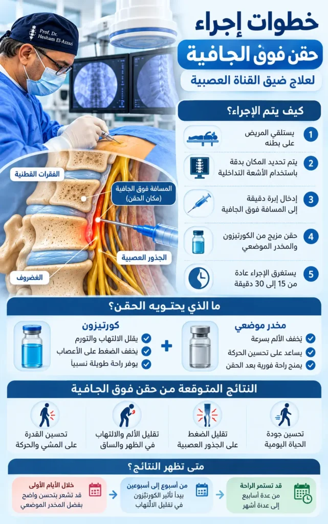 خطوات حقن فوق الجافية لعلاج ضيق القناة العصبية